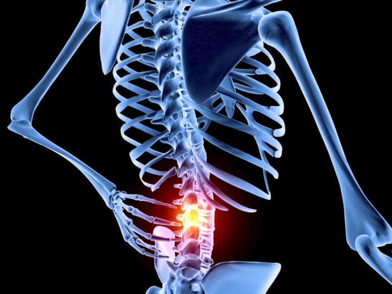 Effect of HF-Spinal Cord Stimulation on Chronic Pain Varies by Sex